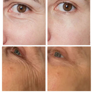 Instant Eye Tightener